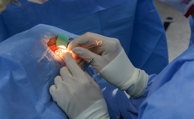Surgery