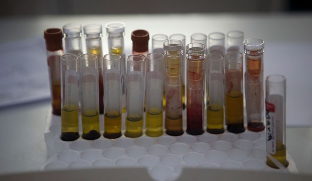 blood samples with Zika